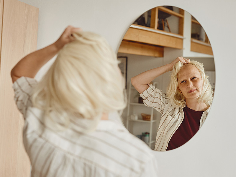 Blick in den Spiegel einer kahlköpfigen Frau, die eine Perücke abnimmt – Symbol für Haarausfall und Selbstbewusstsein.