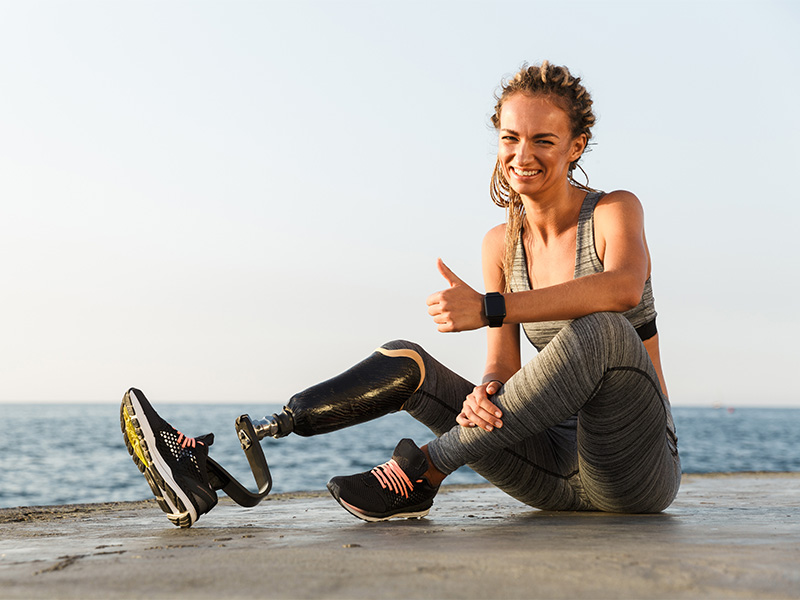 Lächelnde Sportlerin mit Beinprothese zeigt aktive Mobilität und Einsatz von Prothesen in Kassel im Alltag und Sport.